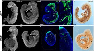 The Mediator Subunit, Med23 Is Required for Embryonic Survival and Regulation of Canonical WNT Signaling During Cranial Ganglia Development